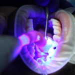 La cigarette électronique est-elle bénéfique pour la santé buccodentaire ?