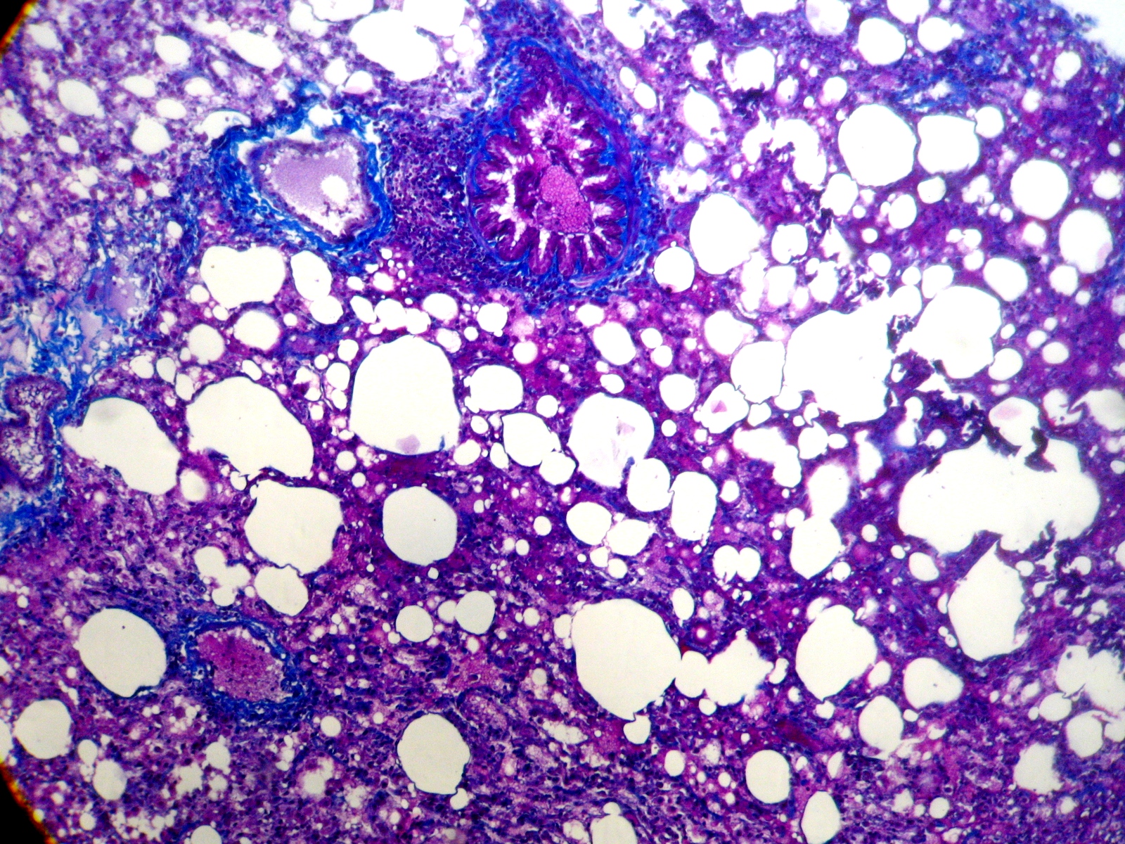 Coupe de tissu pulmonaire de rat colorée, vue au microscope avec alvéoles et bronchiole